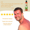 Wild Harvested Cactus Gel - Instant Itch, Rash and Burn Relief -  Wild Cactus Skin Repair Gel